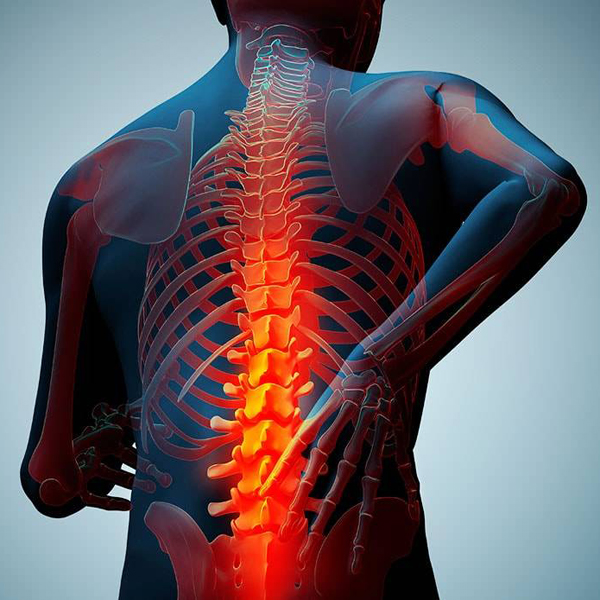 عوامل خطرساز پوکی استخوان چیست؟