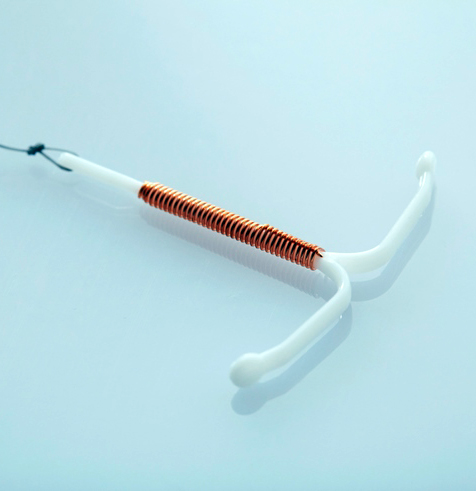چه افرادی می توانند از دستگاه IUD استفاده کنند؟